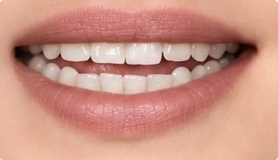 Mouth position for the French vowel [e], as in parlez, été