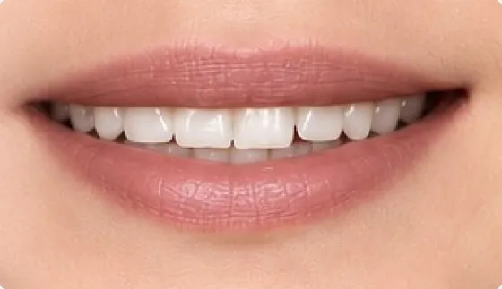 Mouth position for the French vowel [i], as in merci, ici