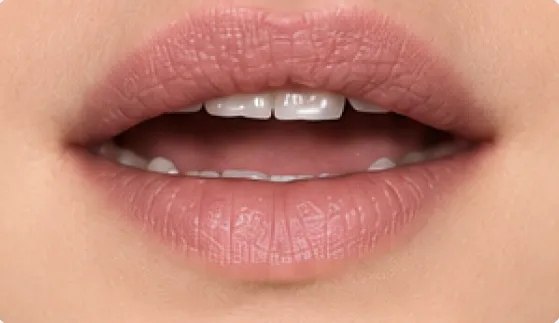 Mouth position for the French vowel [œ], as in fleur, heure